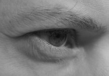 Pat's eye.jpg