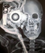 xray_mini.jpg