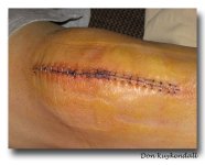 knee1.jpg